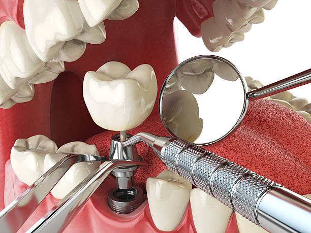 Best Weekend Emergency Dentist in Forestville, OH